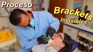 UN DIA EN EL DENTISTA😁👍🏽 Brackets🦷 Michelle Decont