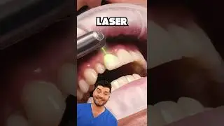 Объяснение принципа действия стоматологического лазера!?