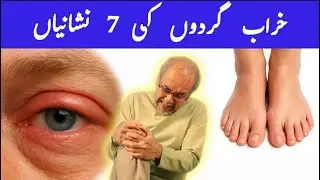 7 WARNING Signs That Your Kidneys Are Toxic| Gurdon k KHARAB Honay ki 7 KHAAS ILAMAAT -DR AYESHA