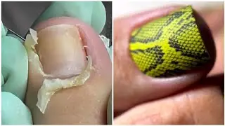 Most Satisfying Pedicure Transformation 😱 best nail polish for toes 2024