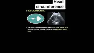 How to measure head circumference on ultrasound #radiology #pregnant #ultrasound