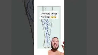 &iquest;Por qu&eacute; aparecen las varices?