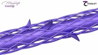 Tesslift - Meshlift Estetiği 3D Animasyon