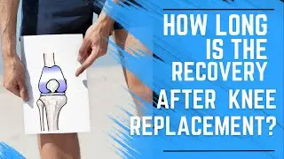 How Long is the Recovery After a Knee Replacement