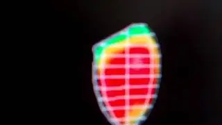 scintigraphie myocardique