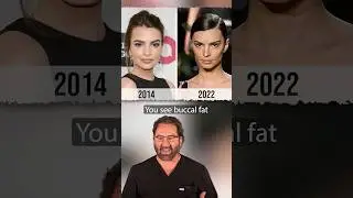Emily Ratajkowski&rsquo;s NEW Look | Plastic Surgeon Reacts
