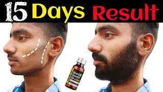 Ustraa Advanced Beard Growth Oil After 15 Days Review|Best Beard Oil For Patchy Beard in India E-875