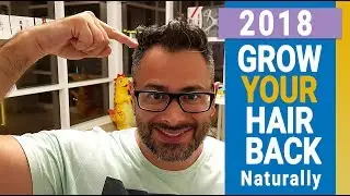 Onion juice for hair regrowth, onion juice  before and after - Onion Hair Oil - Fast Hair Regrowth