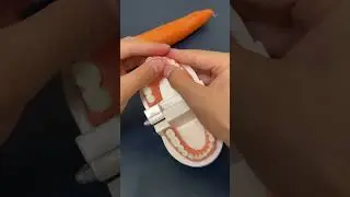 Perfect way to make beautiful teeth #Toothfactory