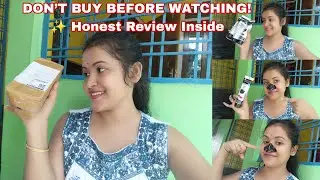 Meesho Charcoal Pills for Dark Spots? SACH Ya JHOOTH! | Honest Review After 7 Days 😱🔥