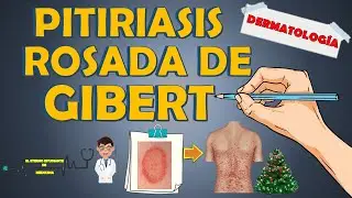 PITIRIASIS ROSADA DE GIBERT ( GILBERT ) - ¿cuánto dura?, clínica, tratamiento📝👨🏻‍⚕️EXPLICACIÓN FÁCIL