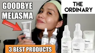 THE ORDINARY 3 BEST PRODUCT FOR MELASMA, HYPERPIGMENTATION/ HOW TO APPLY AZELAIC ACID