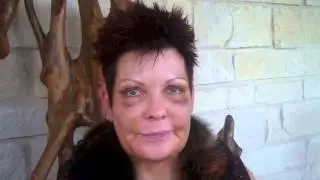 Facelift & Fat Transfer Recovery Diary in Dallas, Texas
