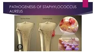 STAPHYLOCOCCUS AUREUS || 1ST YEAR AHS AND 2 ND YEAR BPT|| MICROBIOLOGY||  PHYSIOTHERAPY AND AHS 
