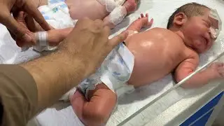 Cute Baby Physio Care 👶 | Tiny Movements, Big Hope #newborn #physiotherapy #babycare #cutebaby 
