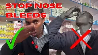 How to Stop a Nosebleed The Right Way (You're Doing It Wrong)