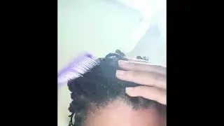 I'm Back w/ Another Ghetto Scratch!! New Upload Y'all! Dandruff Removal (sound on/hairline scratch)