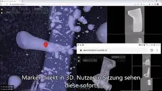 Kollaborative Analyse in CT Daten