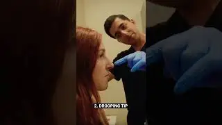 NON SURGICAL Nose Job!