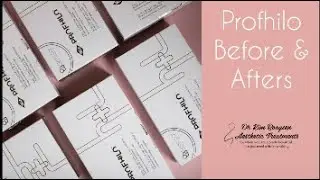 Profhilo Before and After Photos