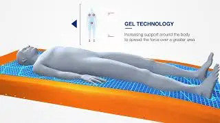 IsoFlex LAL&trade; - Pressure Redistribution