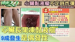 罕見病! 心臟長果凍黏液瘤 9成發生是偶發性  健康2.0