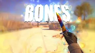 BONES (CS:GO EDIT)