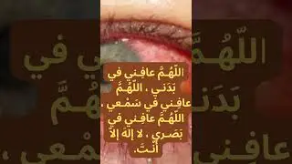 Pink eye conjunctivitis ( Dua for protection)#shorts #dua #viral #virus #eyediseases #pinkeyes