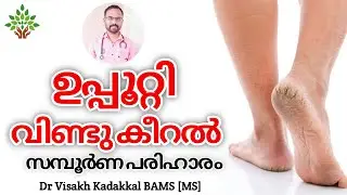 ഉപ്പൂറ്റി വിണ്ടുകീറൽ സമ്പൂർണ പരിഹാരം | Home Remedy for Cracked heels | Dr Visakh Kadakkal