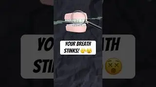 Do Veneers Make Your Breath Stink?🤢