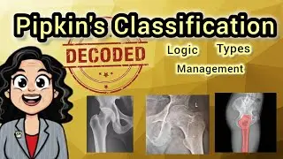 Pipkin's Classification Decoded . Logic Types & Management 