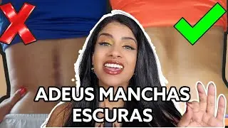 COMO TIREI MANCHAS DAS COSTAS