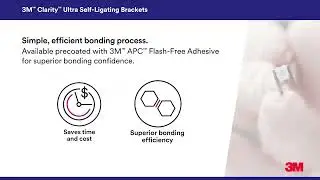 Overview of 3M&trade; Clarity&trade; Ultra Self-Ligating Brackets