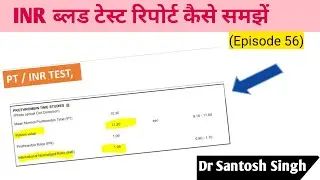How to Read and Interpret INR Test Report? PT-INR for Coagulation (Episode 56)| Dr Santosh Singh