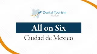 All on Six Dental Implants - Ciudad de Mexico