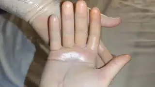 Condom-like Biogel Eclipse latex surgical gloves