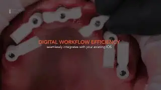 DIRECTscan&trade;: A simplysmarter&trade; fully digital full-arch solution