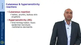 53 Management of Adverse effects to anti TB drugs Session 02