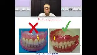 os 5 maiores erros de uma dentadura