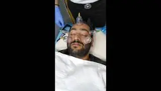 Facial cupping therapy
