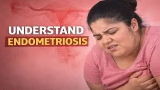 ENDOMETRIOSIS After Hysterectomy  is Back #19 in Surgery for my Daughter