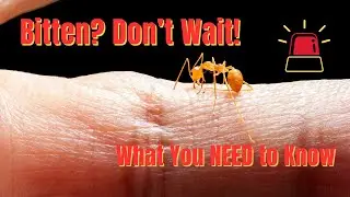 Fire Ant Bites: What to Do, What to Avoid & When It&rsquo;s Dangerous