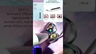 Dra Hazel Jarqu&iacute;n from Nicaragua Loves Refine Medical Endo Activator
