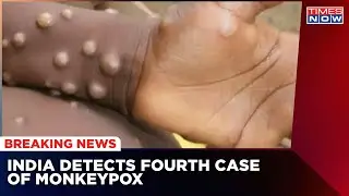 Monkeypox: Meeting Chaired By Union Health Minister Amid 4th Case Reported In Delhi