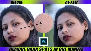 How to remove dark spots from face in photoshop | How to remove pimples from face in photoshop 7.0