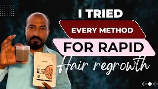 I Tried Every Method For Rapid Hair Regrowth 1 #captureride #jamalgota #hairgrowth #hair #haircare