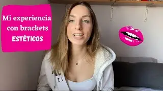 Mi Experiencia con BRACKETS EST&Eacute;TICOS