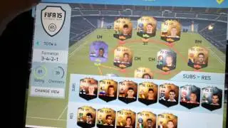 5 million coin pack opening