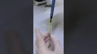 Sperm Vitality Test🔬 #love #shorts #youtubeshorts #trending #science #microbialworld
