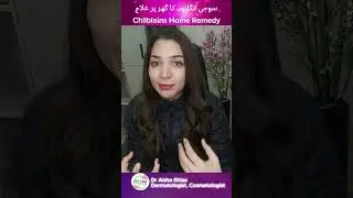 Chilblains Home Remedy l Chilblains Treatment l Winter Skincare #draishaghias